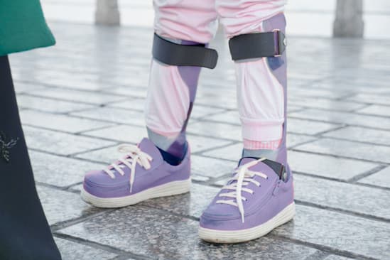 Ein Paar Kinderbeine in lila Beinorthese und Schuhen. Ein Paar Kinderbeine in lila Beinorthese und Schuhen.