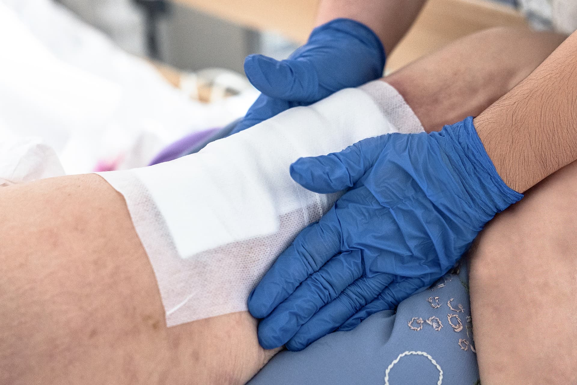 Eine Pflegekraft versorgt das Bein eines Patienten und deckt die Wunde vorsichtig mit Verbänden ab Eine Pflegekraft versorgt das Bein eines Patienten und deckt die Wunde vorsichtig mit Verbänden ab